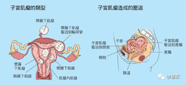 “乳房不摸，小心被割”！别不信！(图12)